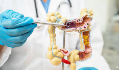 colorectal surgery